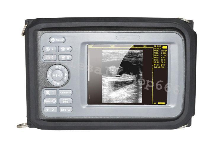 Portable Handheld Digital Ultrasound Scanner machine Micro-convex Probe medical DIAGNOSTIC ULTRASOUND MACHINES FOR SALE