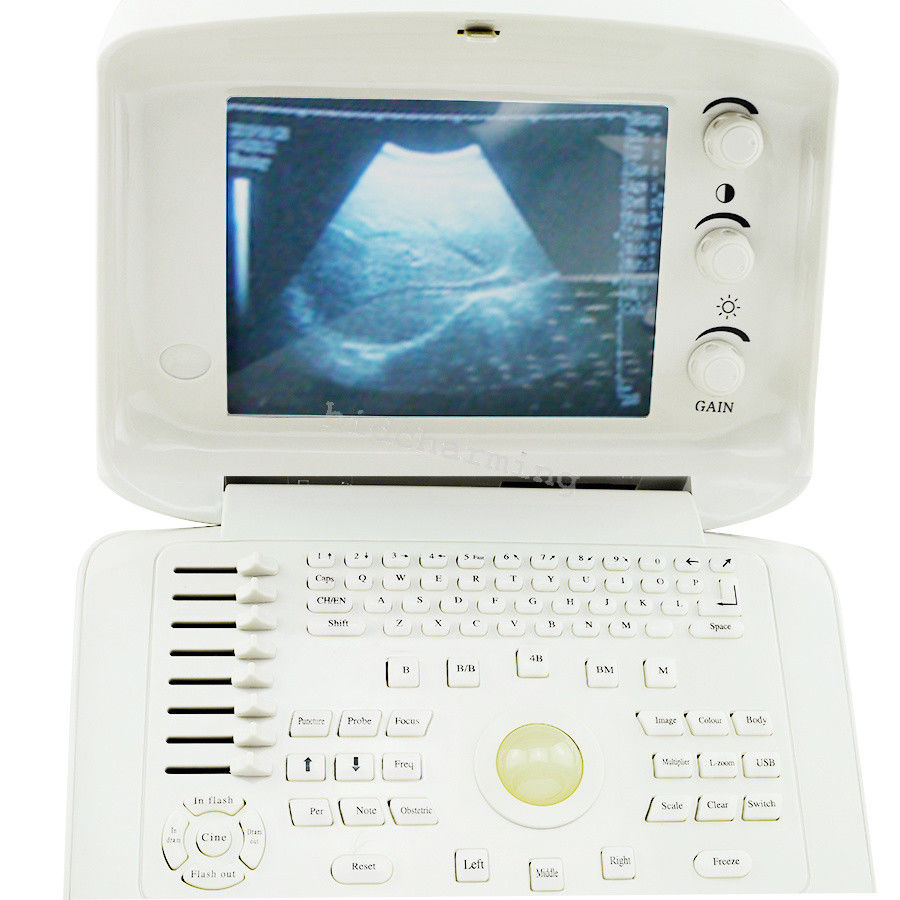 LCD digital potable Ultrasound Scanner monitor + Linear probe + 3D work station 190891664204 DIAGNOSTIC ULTRASOUND MACHINES FOR SALE