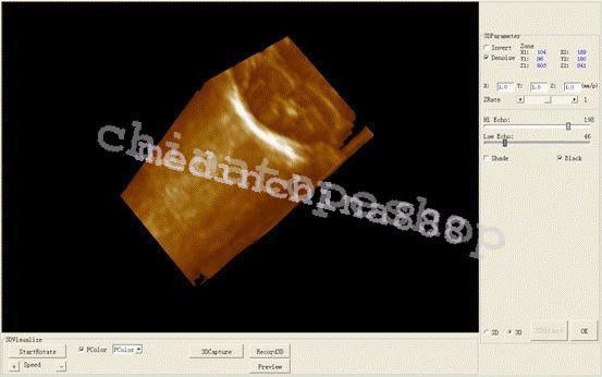 Hospital 10" Digital Ultrasound Scanner Machie Convex + Linear +Viginal 3 Probe DIAGNOSTIC ULTRASOUND MACHINES FOR SALE