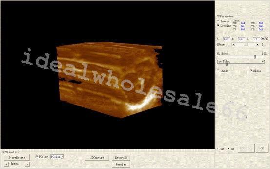 Digital Laptop Ultrasonic Ultrasound Scanner/Machine 7.5M Vascular Linear Probe DIAGNOSTIC ULTRASOUND MACHINES FOR SALE