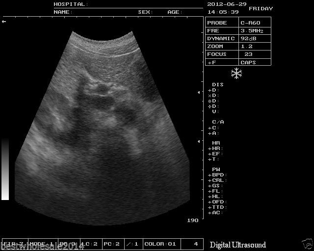 veterinarian B Ultrasound Scanner Machine Micro-convex Array Probe Animals 3D 190891743565 DIAGNOSTIC ULTRASOUND MACHINES FOR SALE