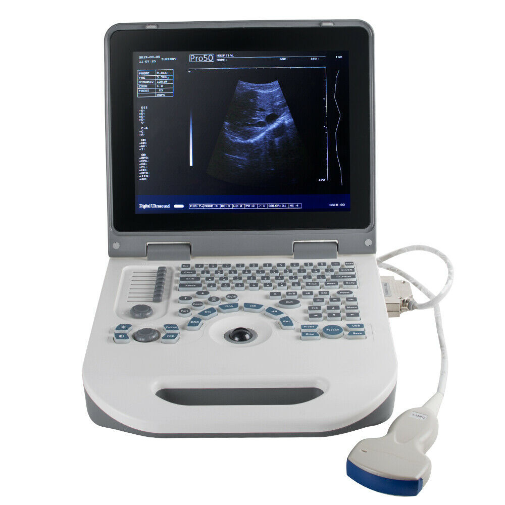 Portable Laptop Machine Digital Ultrasound scanner 3.5MHz Convex probe 3D Staion DIAGNOSTIC ULTRASOUND MACHINES FOR SALE