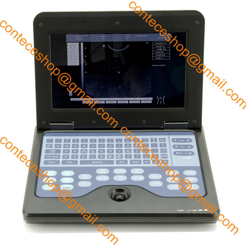Portable laptop machine digital ultrasound scanner+probe for human,USA Warehouse DIAGNOSTIC ULTRASOUND MACHINES FOR SALE
