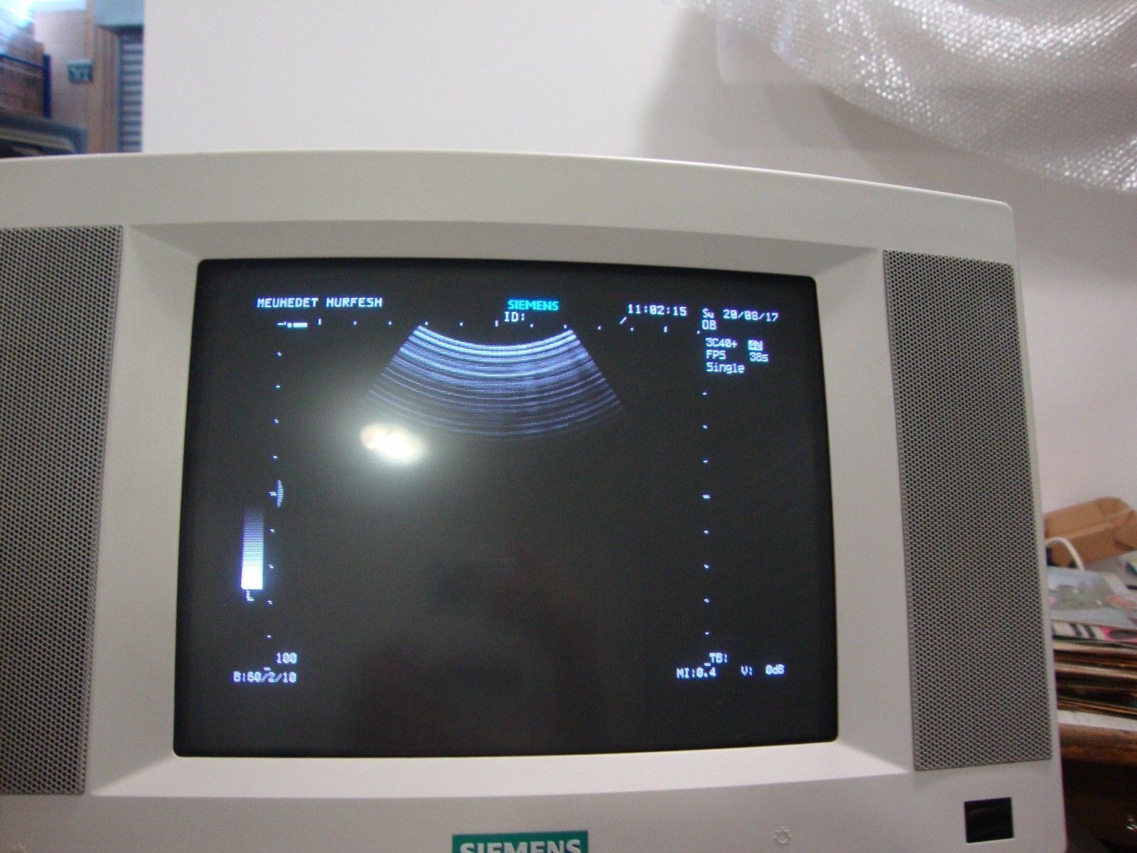 siemens sienna diagnostic ultrasound system GM-6601A2E00 2002 DIAGNOSTIC ULTRASOUND MACHINES FOR SALE