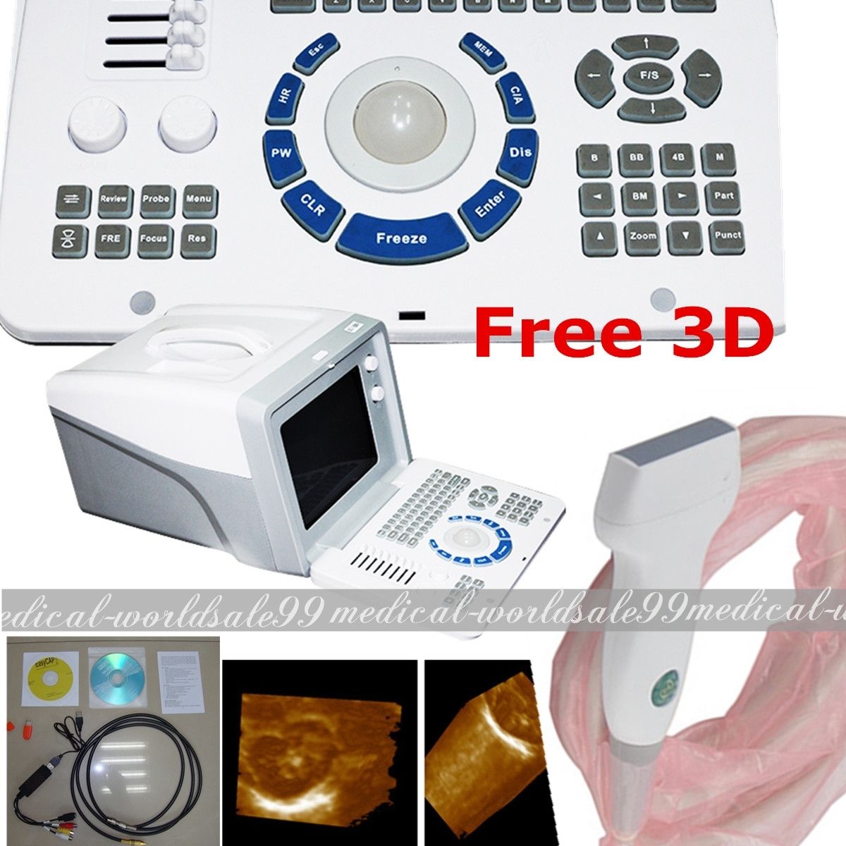 Portable Digital Ultrasound Scanner/Machine 7.5M Linear Probe/Transducer USB A+ DIAGNOSTIC ULTRASOUND MACHINES FOR SALE