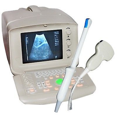 Portable ultrasound bladder scanner system Convex Transvaginal probe 3D Software DIAGNOSTIC ULTRASOUND MACHINES FOR SALE