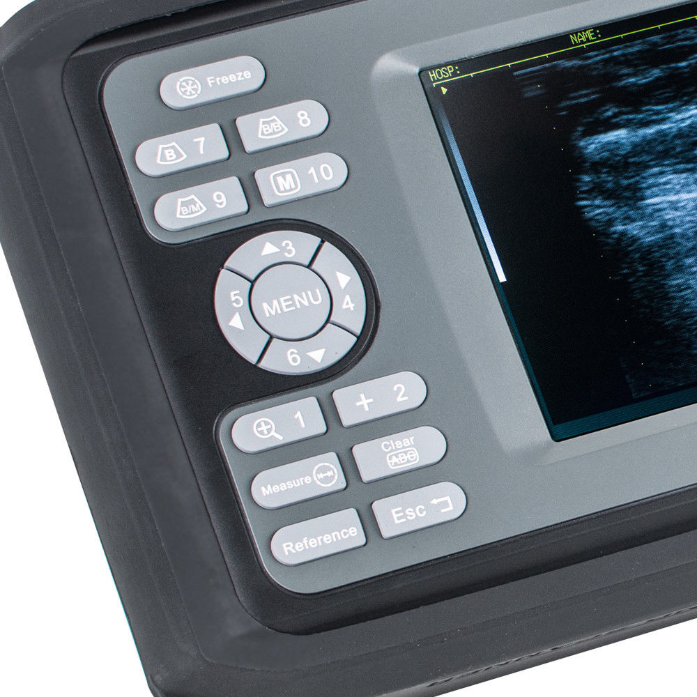 Factory Handheld PalmSmart Ultrasound Scanner/Machine Cardiac Micro-Convex Probe DIAGNOSTIC ULTRASOUND MACHINES FOR SALE