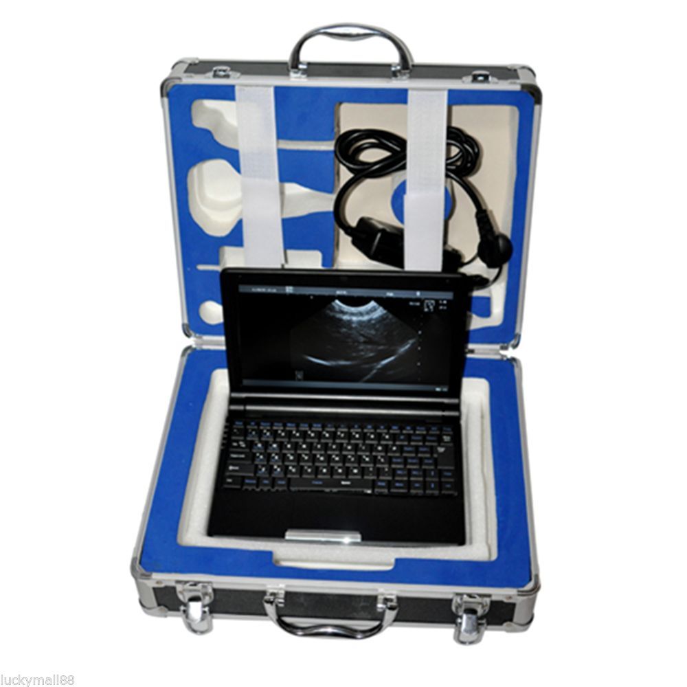 Portable ultrasound scanner laptop machine 3 Probes Convex/Linear/Transvaginal DIAGNOSTIC ULTRASOUND MACHINES FOR SALE