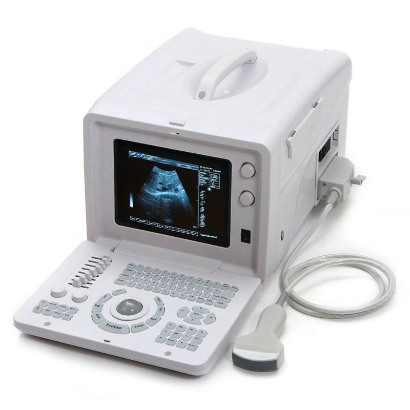 Ultrasonic Ultrasound Scanner Ultrasound Scanning+7.5Mhz Linear Array probe CE DIAGNOSTIC ULTRASOUND MACHINES FOR SALE