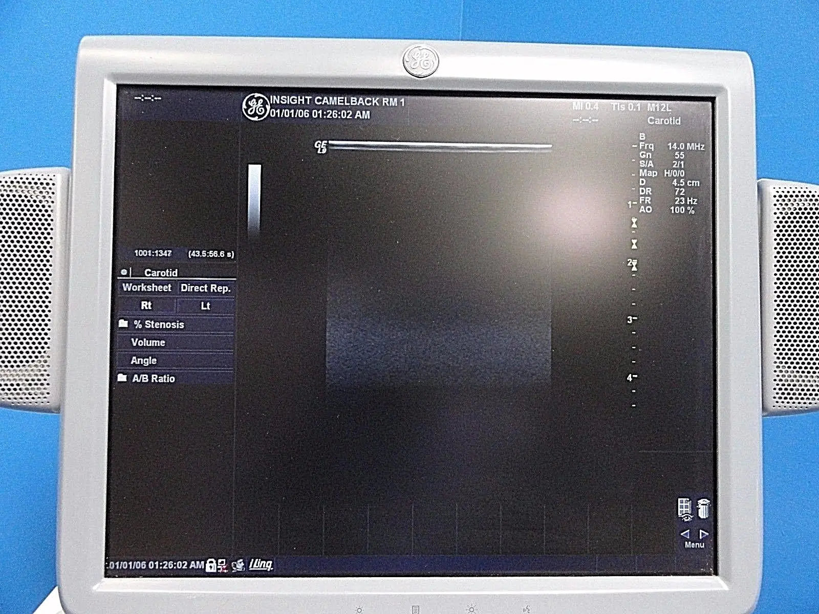 GE M12L P/N 2294512 Linear Array Ultrasound Probe for Logiq & Vivid Series~13722 DIAGNOSTIC ULTRASOUND MACHINES FOR SALE