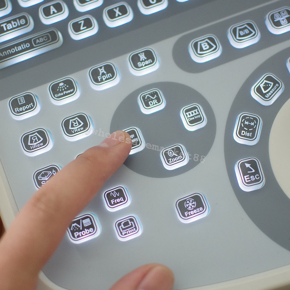 Portable Ultrasound Machine Scanner System Convex probe 3D Software Image Photo 190891045898 DIAGNOSTIC ULTRASOUND MACHINES FOR SALE