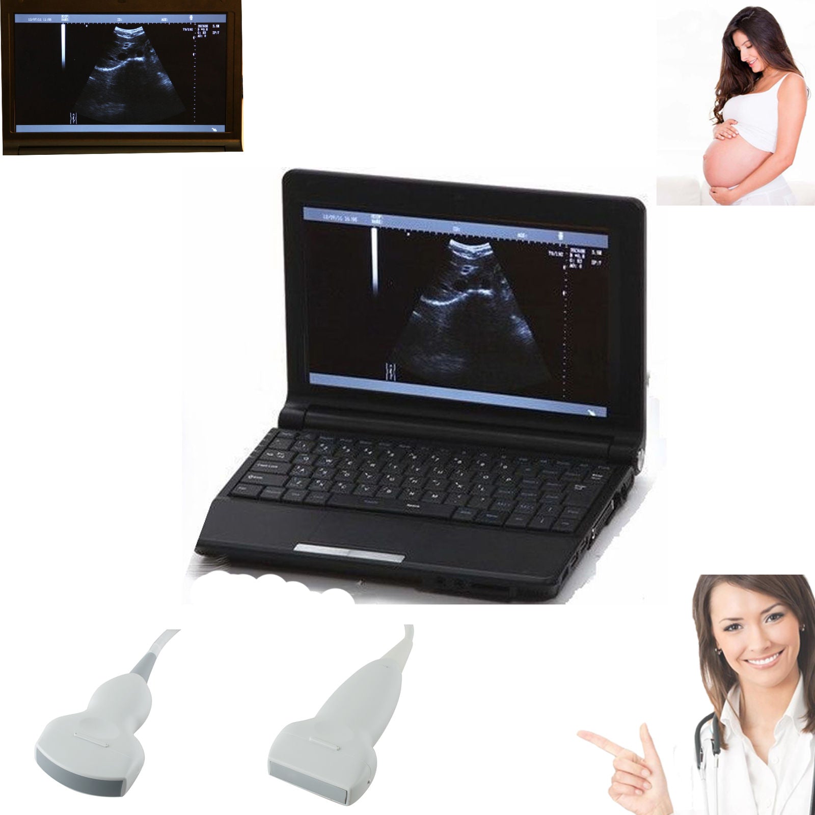 Digital Laptop External 3D Ultrasound Scanner+ Convex & Linear Probe 10" LCD CE 190891750662 DIAGNOSTIC ULTRASOUND MACHINES FOR SALE