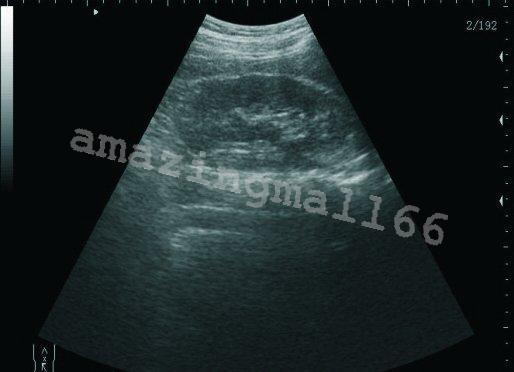 Digital Laptop Machine Ultrasound Scanner + 7.5 Linear Probe/Transducer +3D CE 190891468864 DIAGNOSTIC ULTRASOUND MACHINES FOR SALE