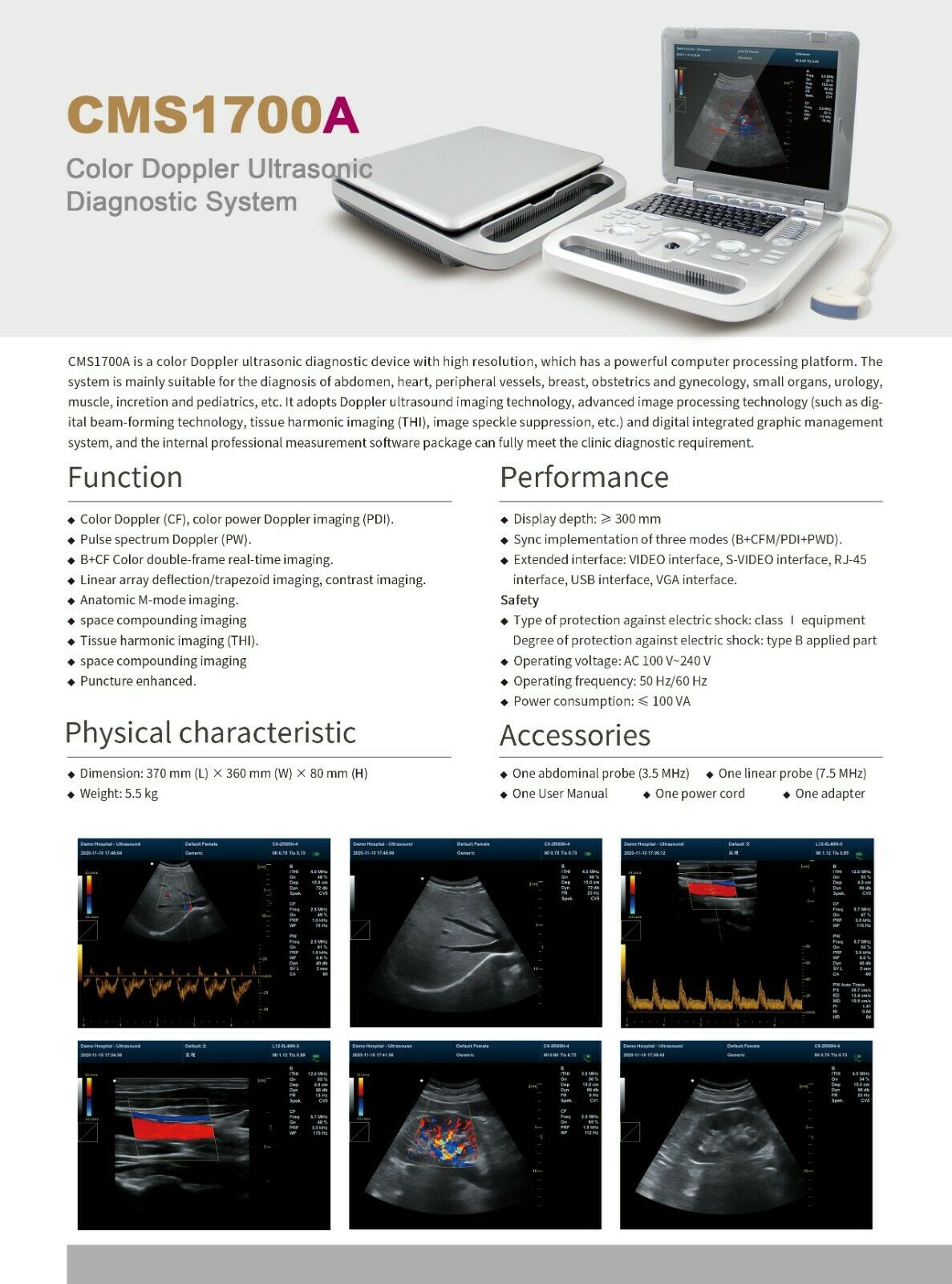 Portable High Resolution Color Doppler Ultrasound Scanner with Convex Probe New 6945040100362 DIAGNOSTIC ULTRASOUND MACHINES FOR SALE