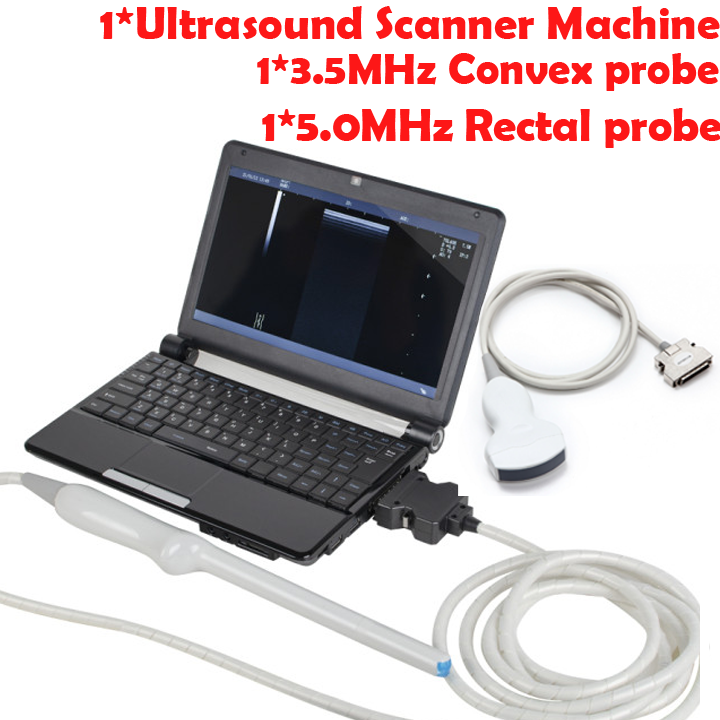 Medical Laptop Machine Ultrasound Scanner 7.5MHz Linear Transvaginal 2 Probes DIAGNOSTIC ULTRASOUND MACHINES FOR SALE