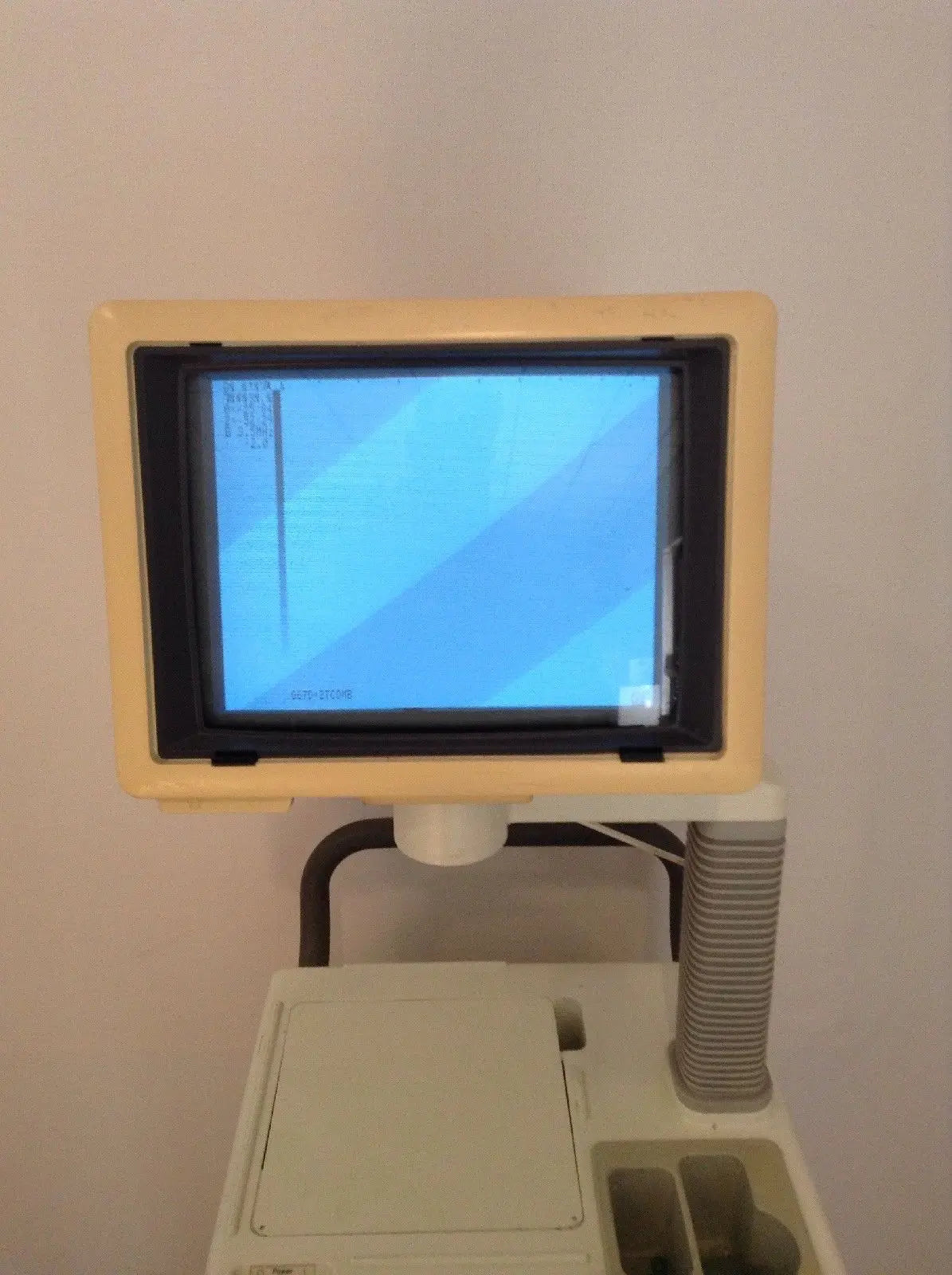 GE RT3200-ADVANTAGE-II DIAGNOSTIC ULTRASOUND SYSTEM 14825 with Sony Printer DIAGNOSTIC ULTRASOUND MACHINES FOR SALE