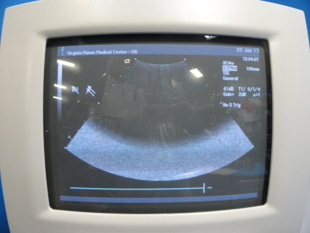 Acuson 8C4 P/N 08247450 Convex Probe W/ Pin Less Connector For Sequoia ~12523 DIAGNOSTIC ULTRASOUND MACHINES FOR SALE