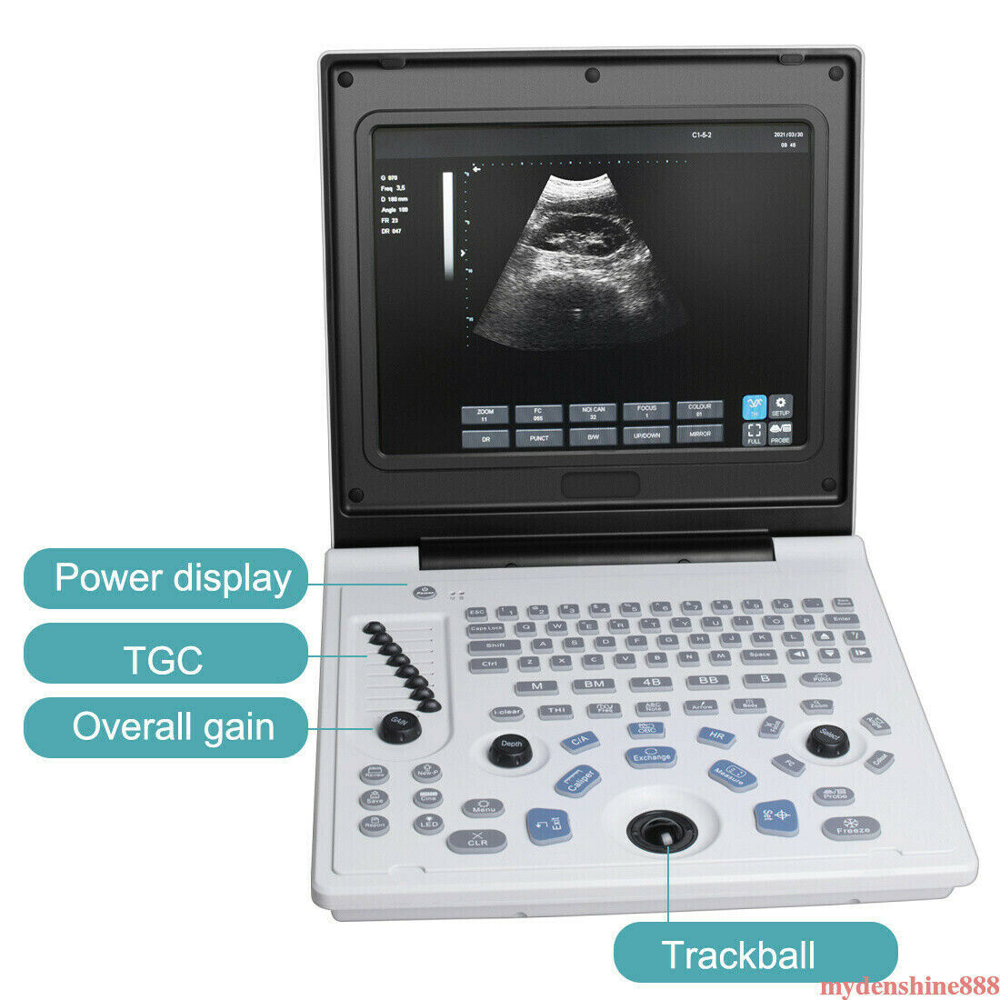 Portable 12" Full Digital Ultrasound Scanner Machine + 3.5MHz Convex Probe Human DIAGNOSTIC ULTRASOUND MACHINES FOR SALE