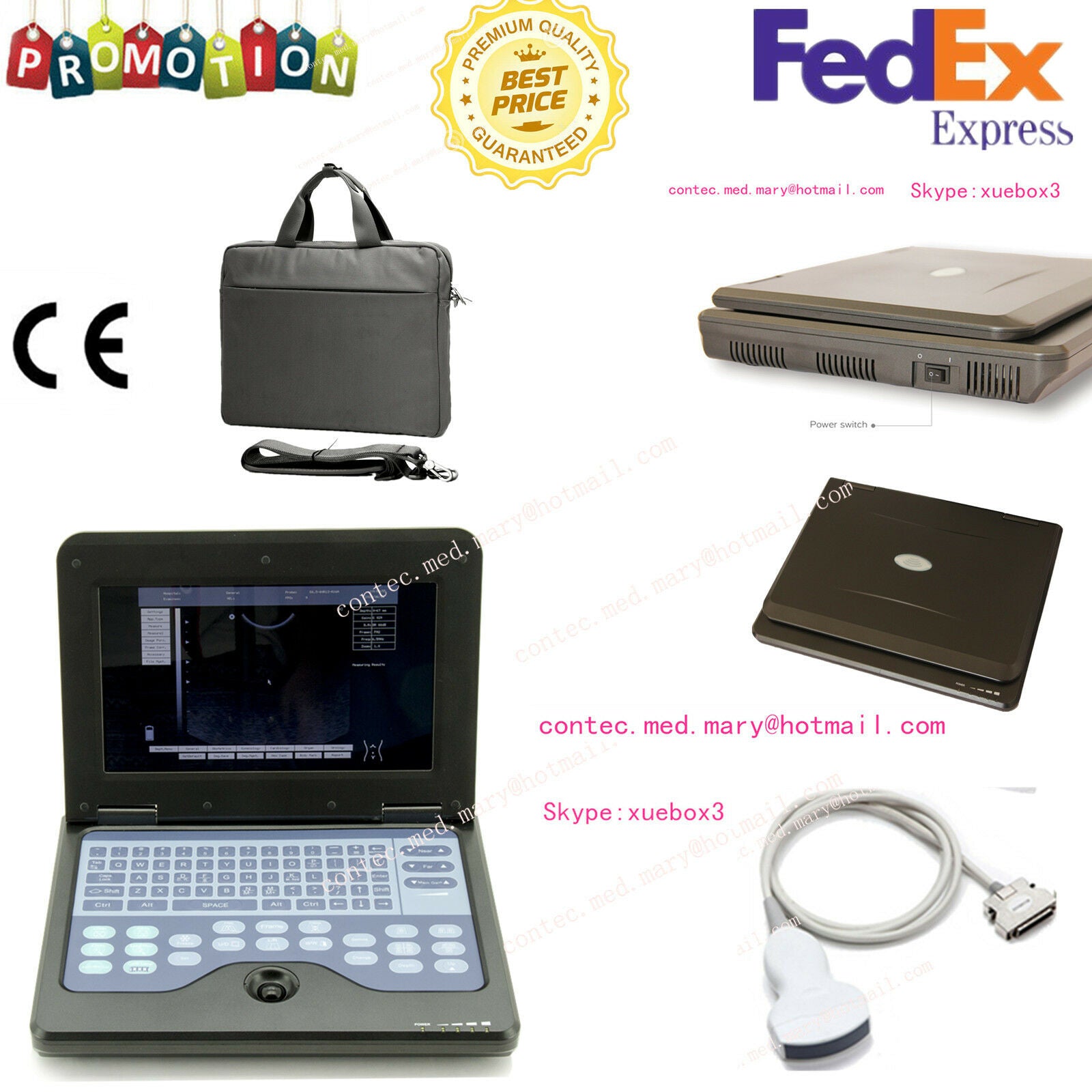 New CE Portable USB Digital Ultrasound machine Scanner +3.5 Mhz CONVEX Probe,USA 658126883672 DIAGNOSTIC ULTRASOUND MACHINES FOR SALE