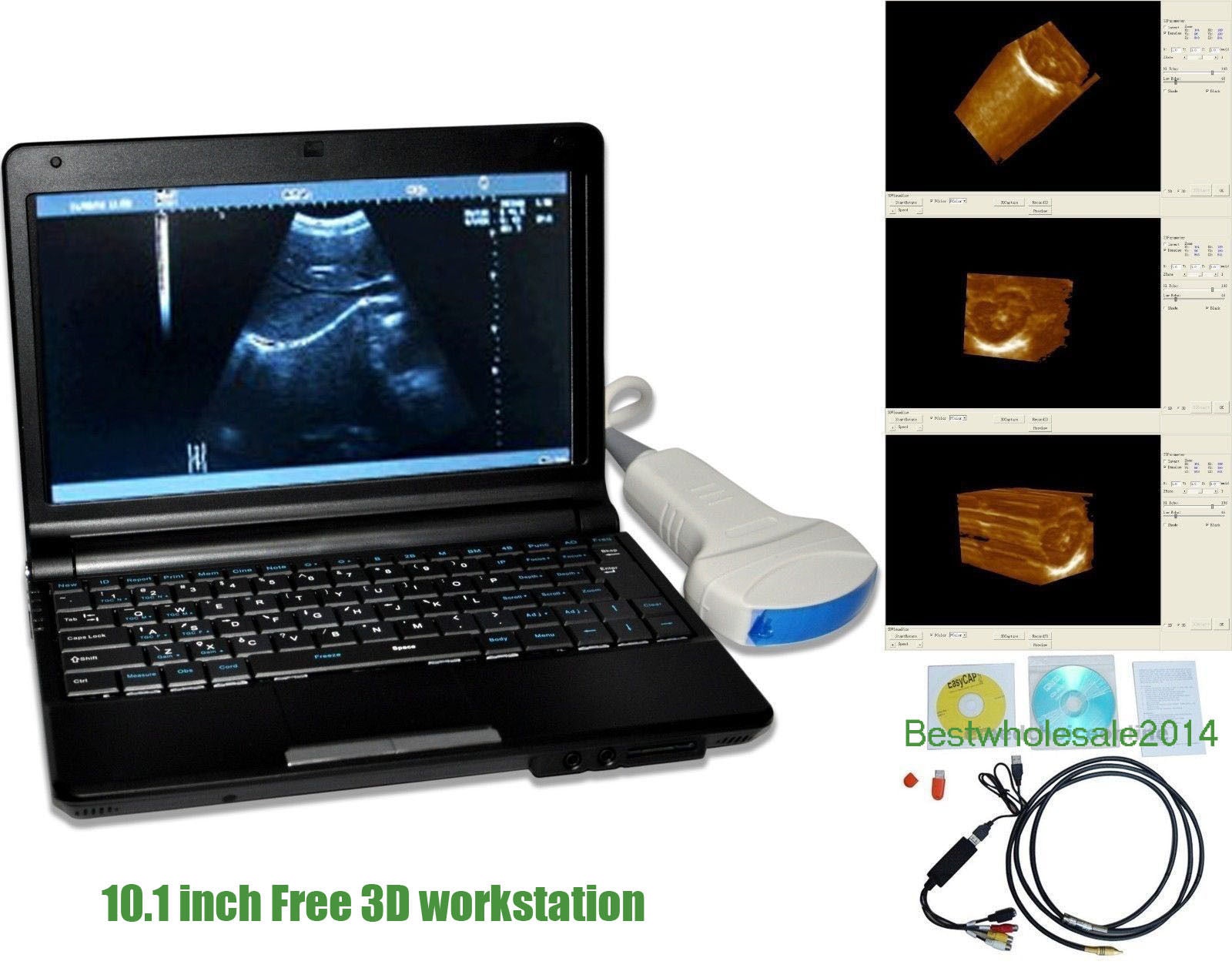 10.1 Ultrasound Scanner Diagnostic Machine Micro-Convex + linear Probe USB port DIAGNOSTIC ULTRASOUND MACHINES FOR SALE