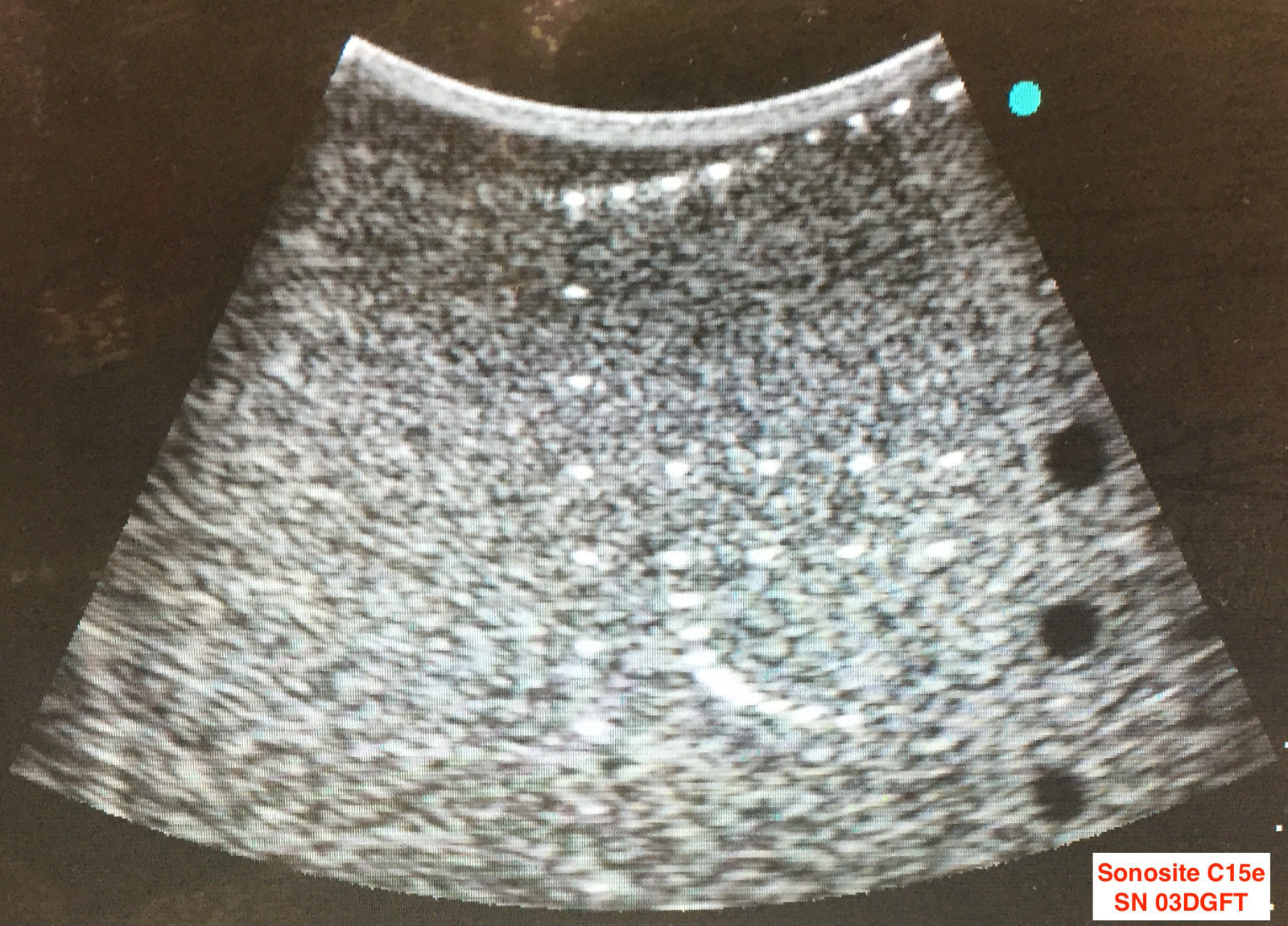 2008 SonoSite C15e /4-2 MHZ Curved Ultrasound Transducer Probe REF P02461-08 DIAGNOSTIC ULTRASOUND MACHINES FOR SALE