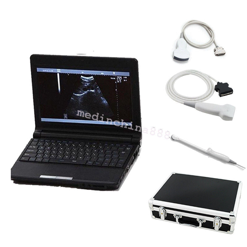 Laptop Ultrasound Scanner +Convex+Linear+Transvaginal 3 Probes Free Aluminum Box DIAGNOSTIC ULTRASOUND MACHINES FOR SALE