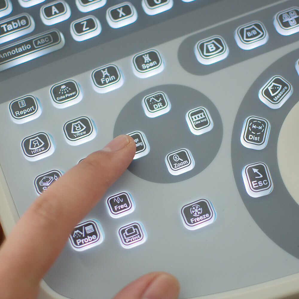 Portable Laptop Ultrasound Scanner 3.5MHz Convex Medical Ultrasound Machine +3D DIAGNOSTIC ULTRASOUND MACHINES FOR SALE