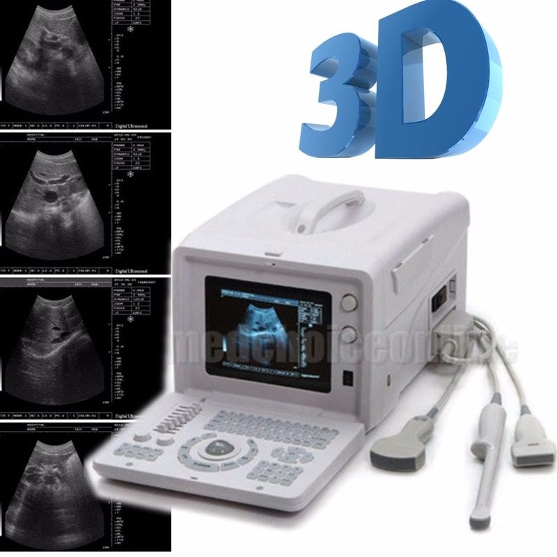 Excellent 10"Digital Ultrasound Machine Covex/ Linear/ Transvaginal 3 Probes USB 190891670403 DIAGNOSTIC ULTRASOUND MACHINES FOR SALE