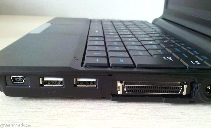 7.5M Linear Probe Full Digital Diagnostic System Ultrasound Scanner Machine New 190891735249 DIAGNOSTIC ULTRASOUND MACHINES FOR SALE