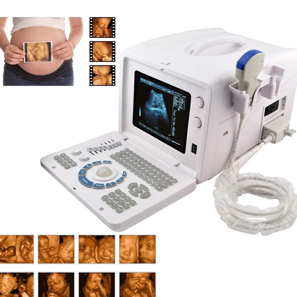Digital Ultrasound machine Scanner Convex + linear Probe +3D Worksation CE Sale 190891802941 DIAGNOSTIC ULTRASOUND MACHINES FOR SALE