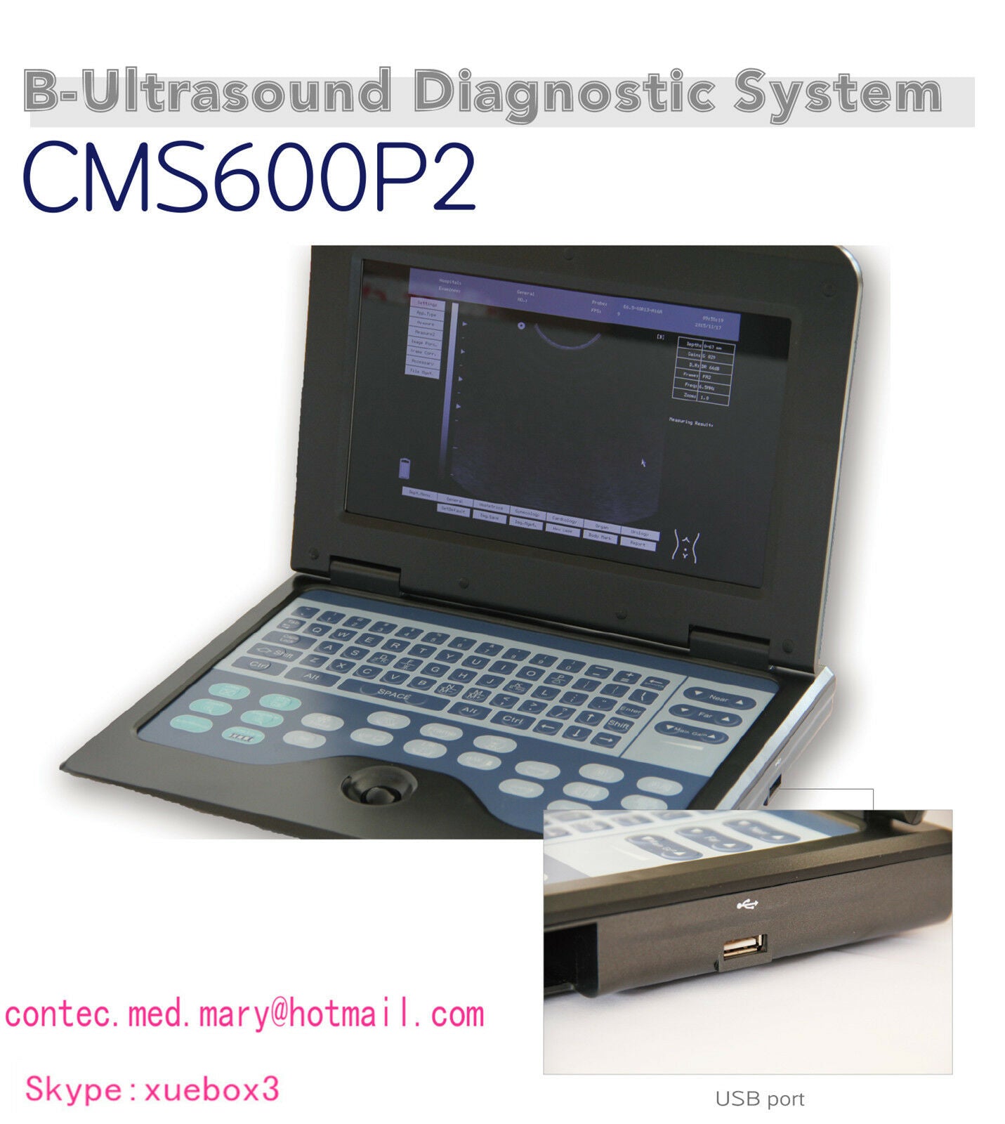 US-Digital-Portable-Ultrasound-Scanner-Machine+Cardiac+Convex Two probes Sale. DIAGNOSTIC ULTRASOUND MACHINES FOR SALE