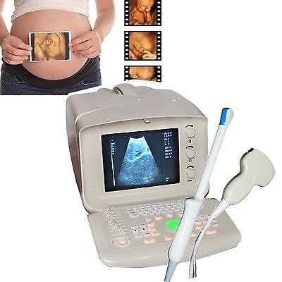 Portable ultrasound bladder scanner system Convex Transvaginal probe 3D Software DIAGNOSTIC ULTRASOUND MACHINES FOR SALE