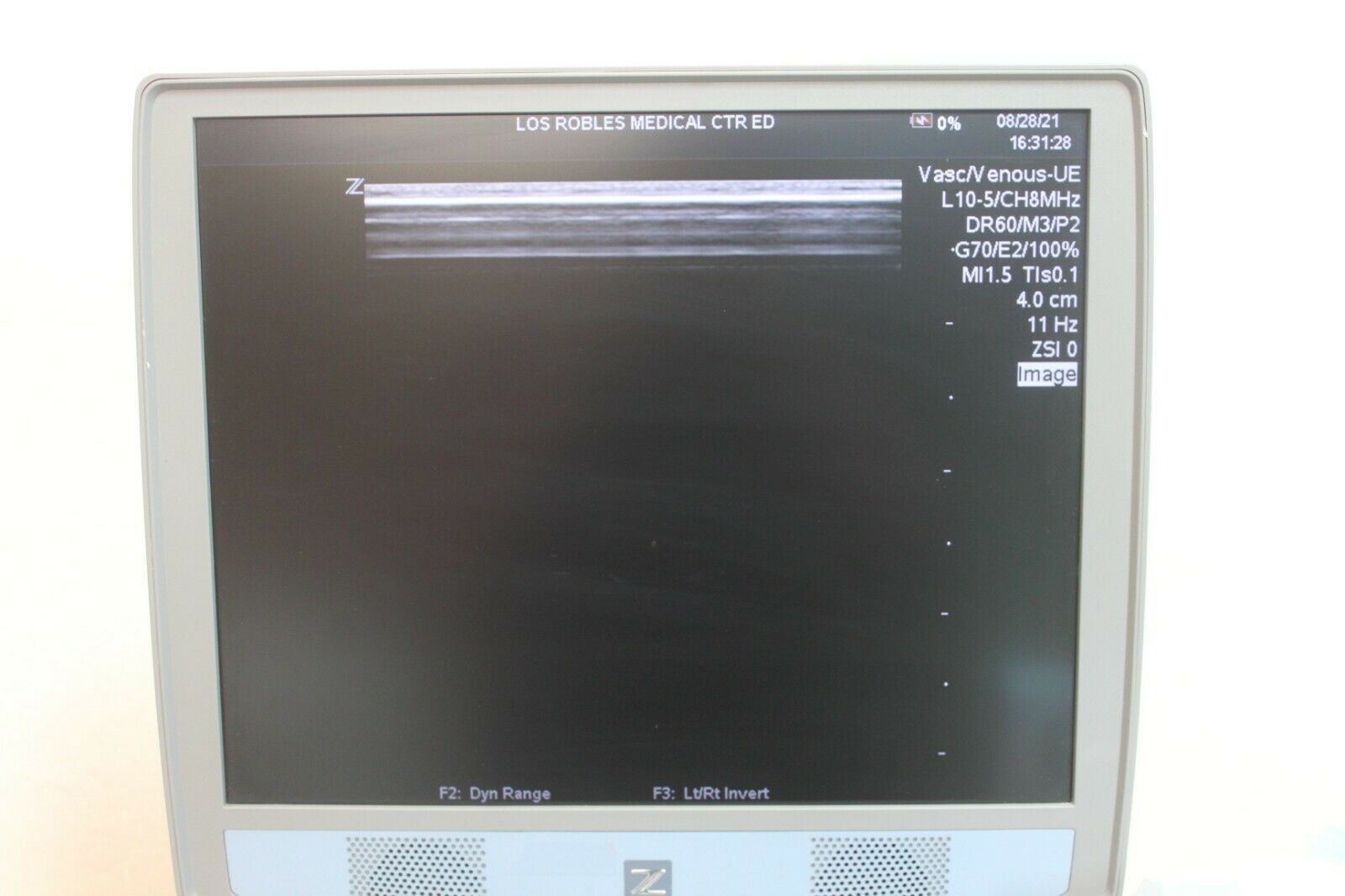 Zonare Z One Ultra Ultrasound with 3 Transducers DIAGNOSTIC ULTRASOUND MACHINES FOR SALE