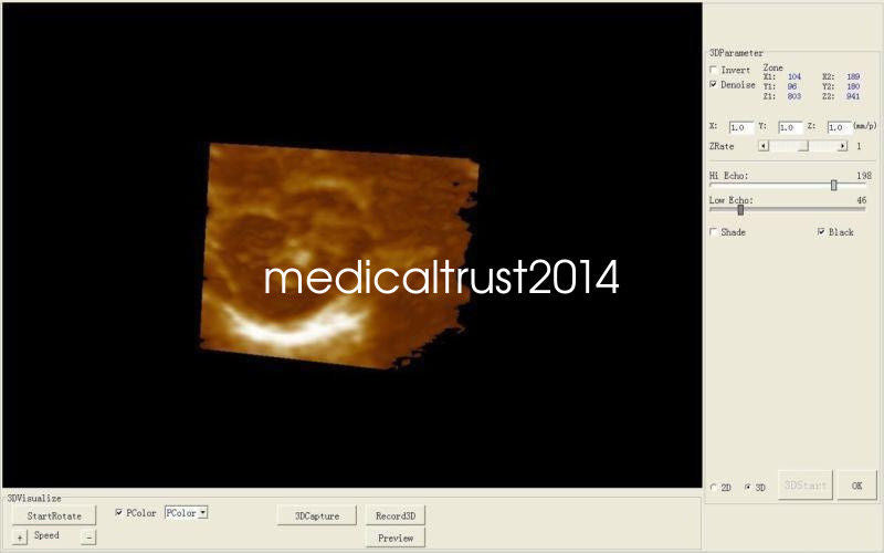 Portable Ultrasound Scanner 3D image With 7.5MHz Linear Probe Medical Pro Tool 190891264060 DIAGNOSTIC ULTRASOUND MACHINES FOR SALE