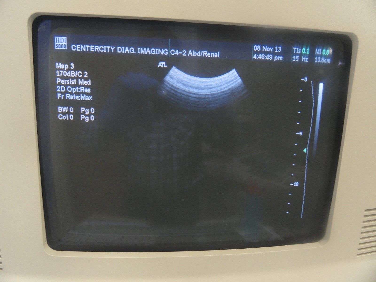 ATL HDI C4-2 40R Curved Array Broadband Probe (Abdominal General Imaging) 5940 DIAGNOSTIC ULTRASOUND MACHINES FOR SALE