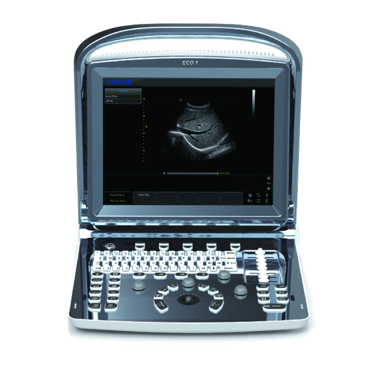 B-W-Ultrasounds DIAGNOSTIC ULTRASOUND MACHINES FOR SALE