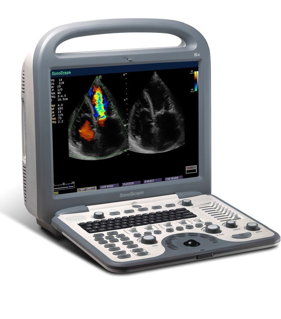 Breast-Ultrasound DIAGNOSTIC ULTRASOUND MACHINES FOR SALE