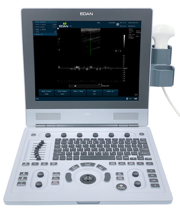 Edan U60 Portable Ultrasound