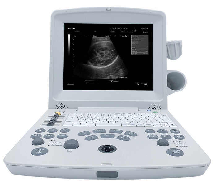 Edan DUS60 Portable Ultrasound