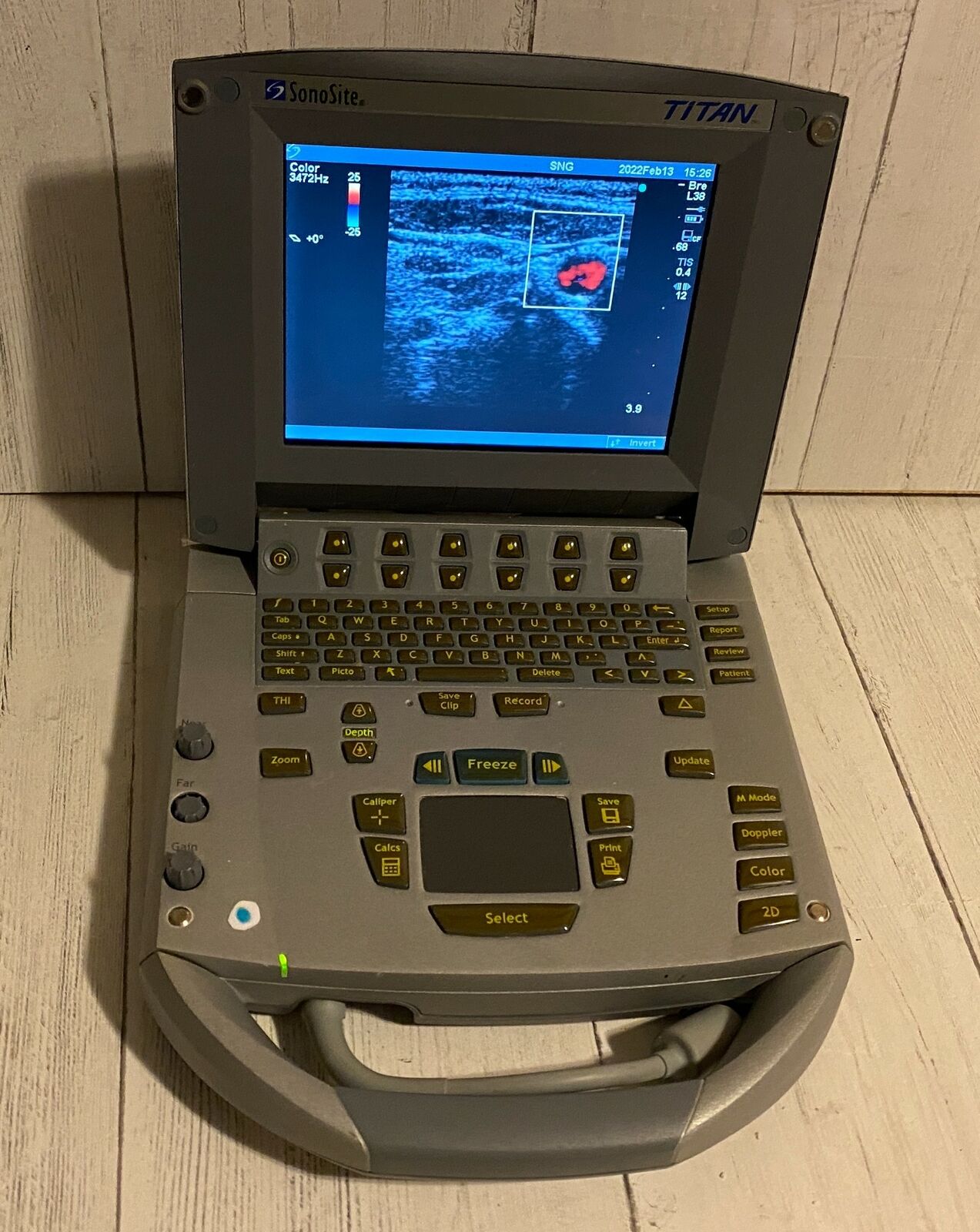 Sonosite Titan Portable Ultrasound 2005 - Main unit