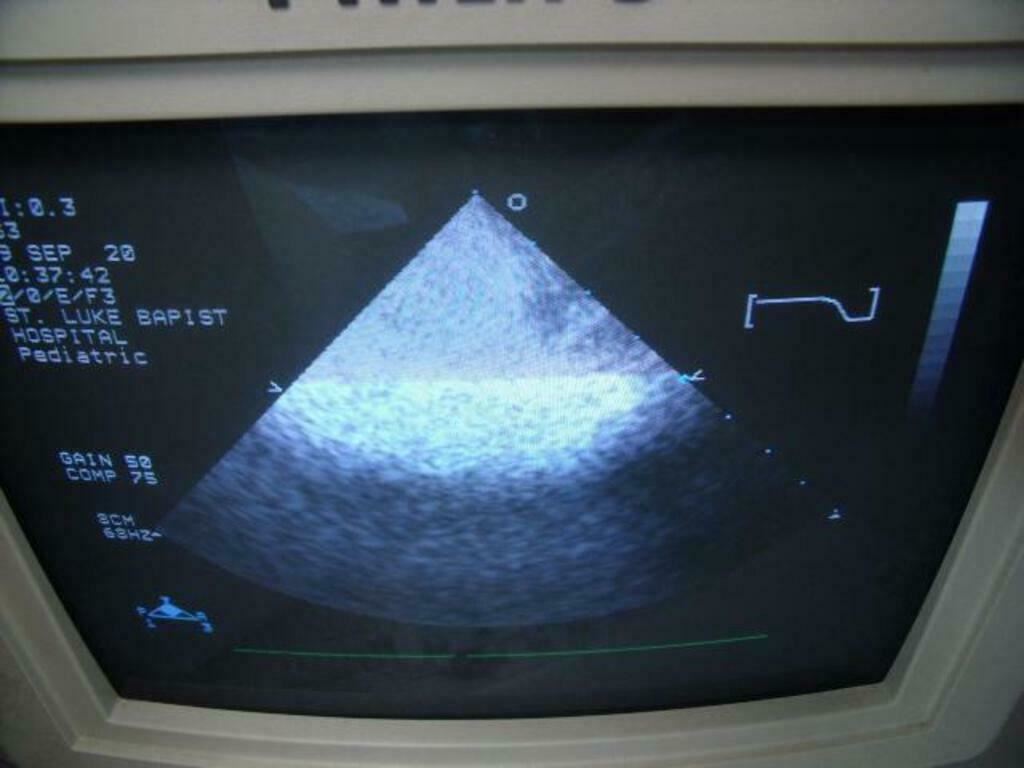 PHILIPS 21311A S3 ULTRASOUND PROBE | PR163 DIAGNOSTIC ULTRASOUND MACHINES FOR SALE