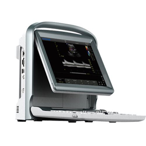 Color Doppler Vascular Ultrasound Scanner with Two Probes, Battery - Chison ECO5 DIAGNOSTIC ULTRASOUND MACHINES FOR SALE