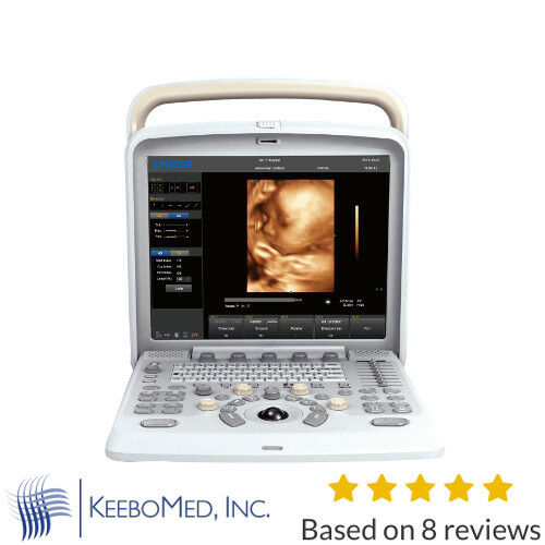Color Doppler Ultrasound Chison Q5, with 4D Probe for Obstetrics and Gynecology DIAGNOSTIC ULTRASOUND MACHINES FOR SALE