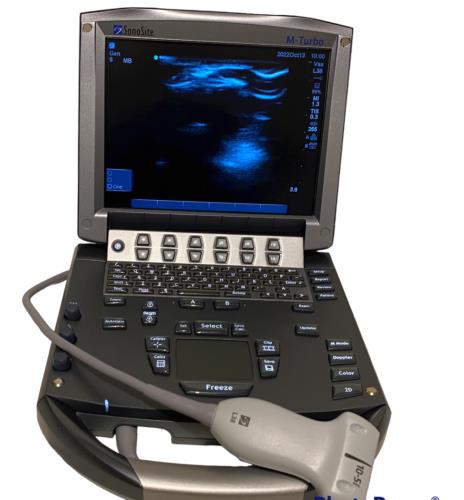 Sonosite M-Turbo Portable Ultrasound 2018 with Linear Array Probe L38xi 10-5 DIAGNOSTIC ULTRASOUND MACHINES FOR SALE