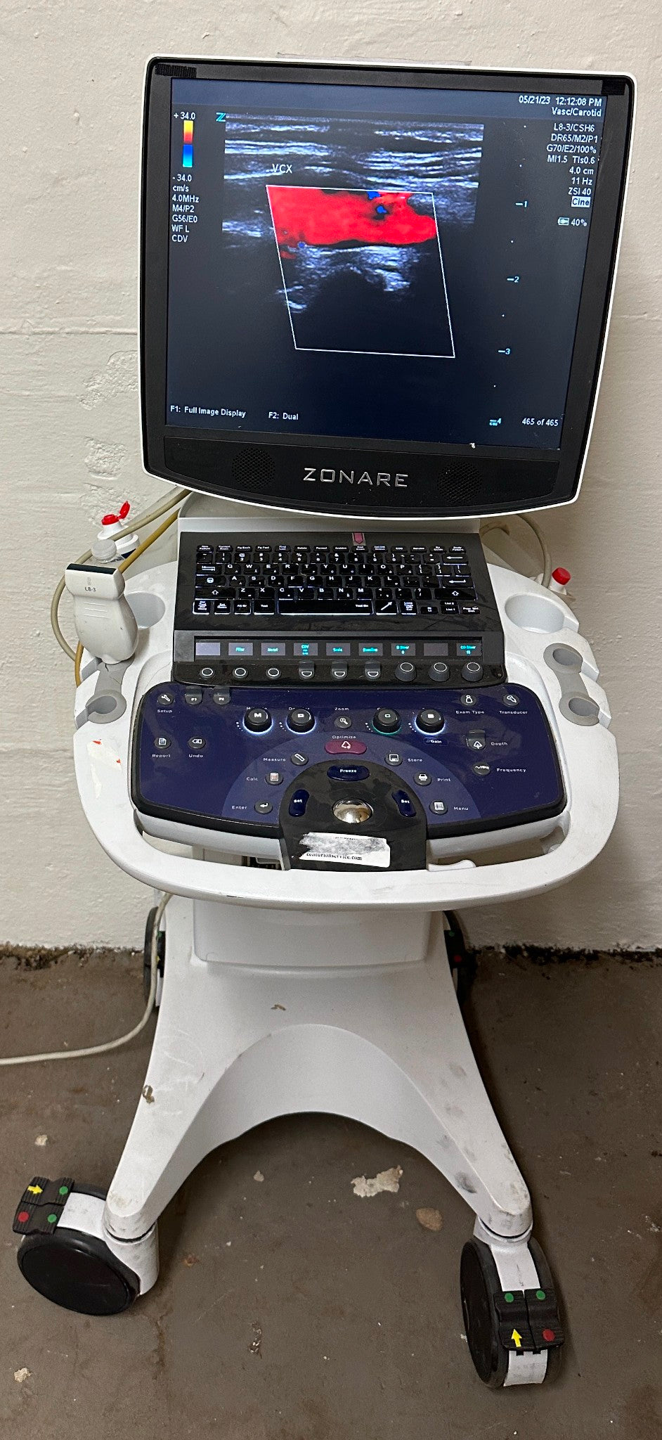ZONARE ZS 3 Ultrasound Scanner Machine  2015 DIAGNOSTIC ULTRASOUND MACHINES FOR SALE