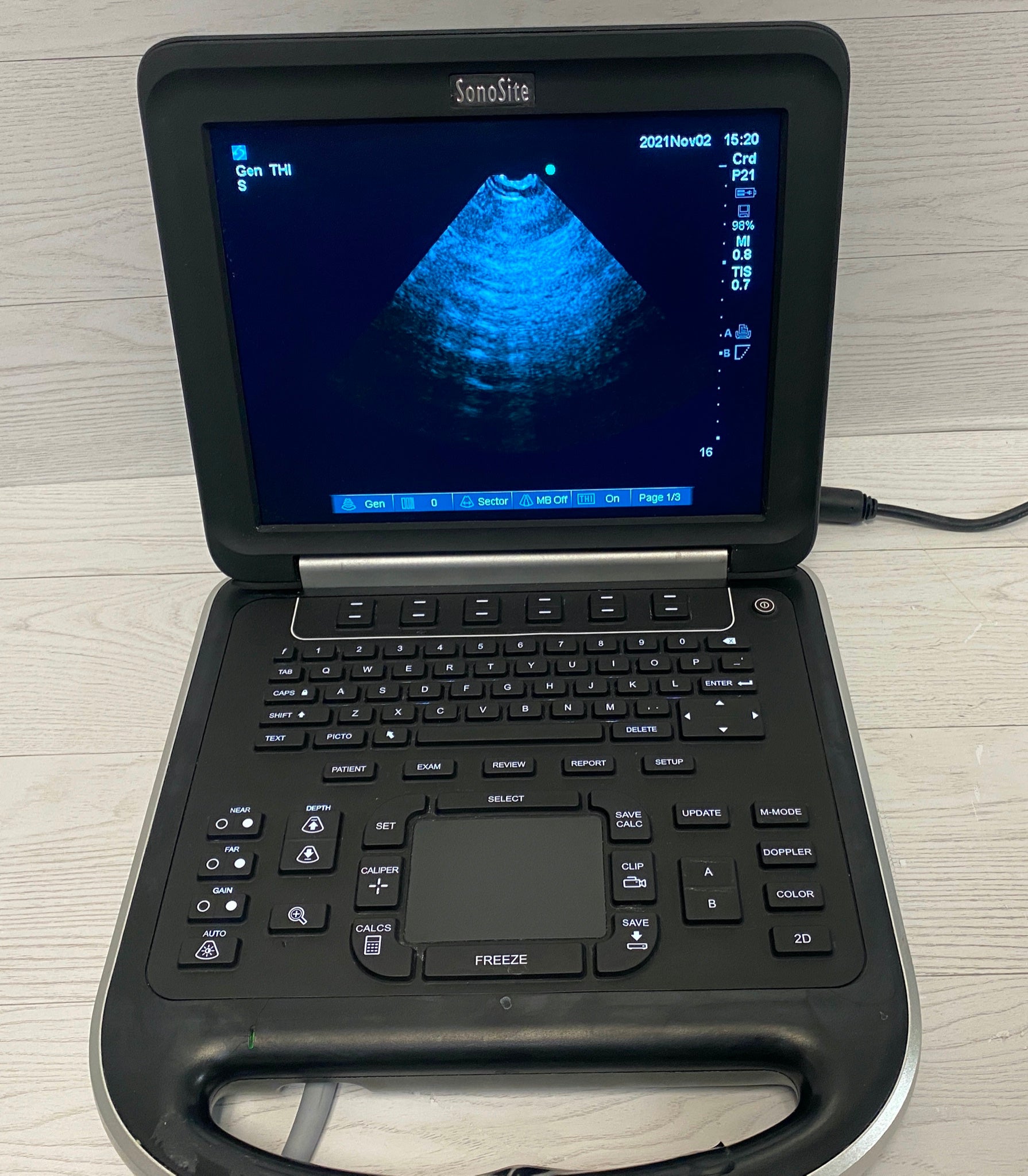 Sonosite Edge Portable ultrasound with P21 Cardiac probe  2012 DIAGNOSTIC ULTRASOUND MACHINES FOR SALE