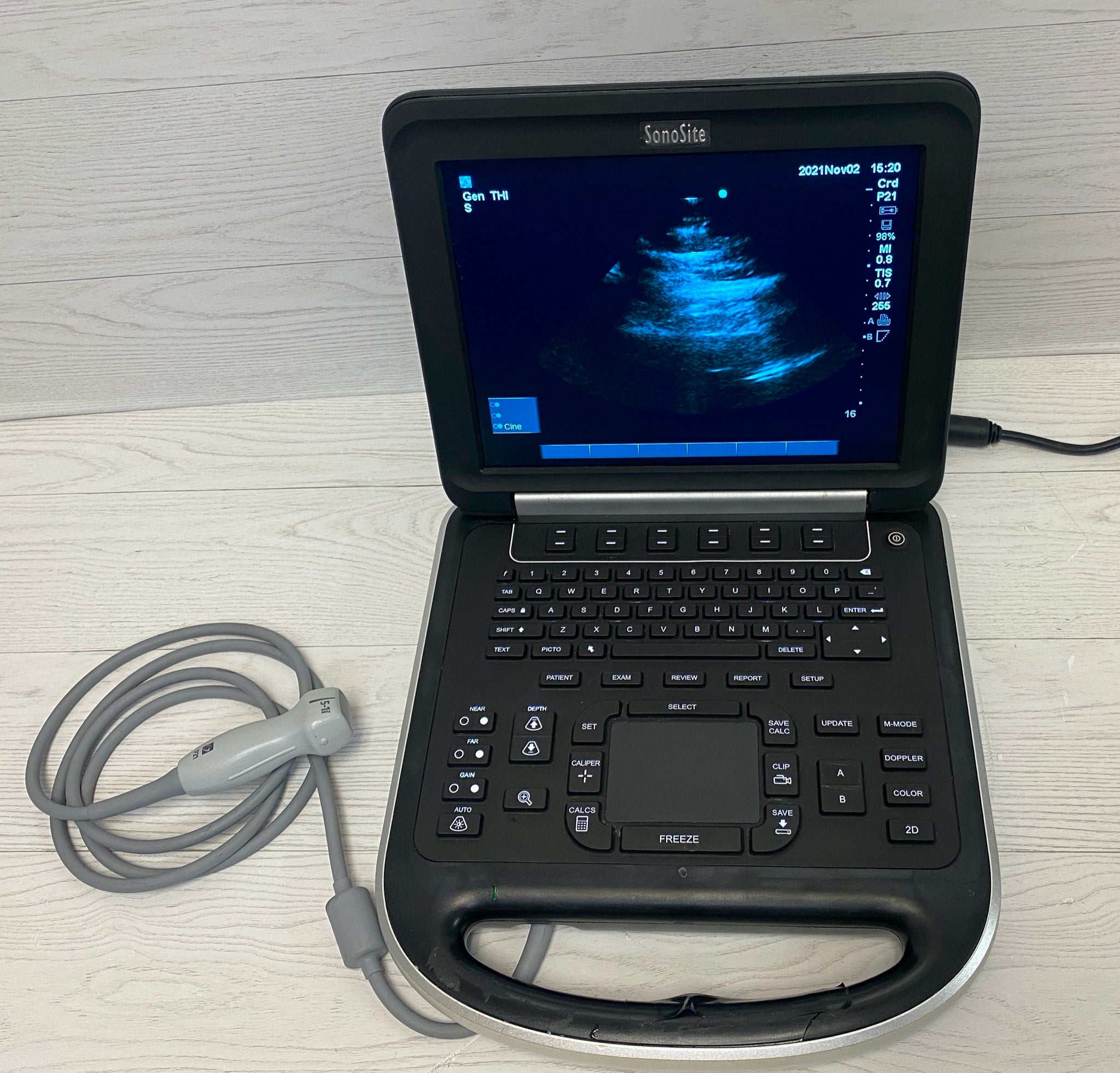 Sonosite Edge Portable ultrasound with P21 Cardiac probe  2012 DIAGNOSTIC ULTRASOUND MACHINES FOR SALE