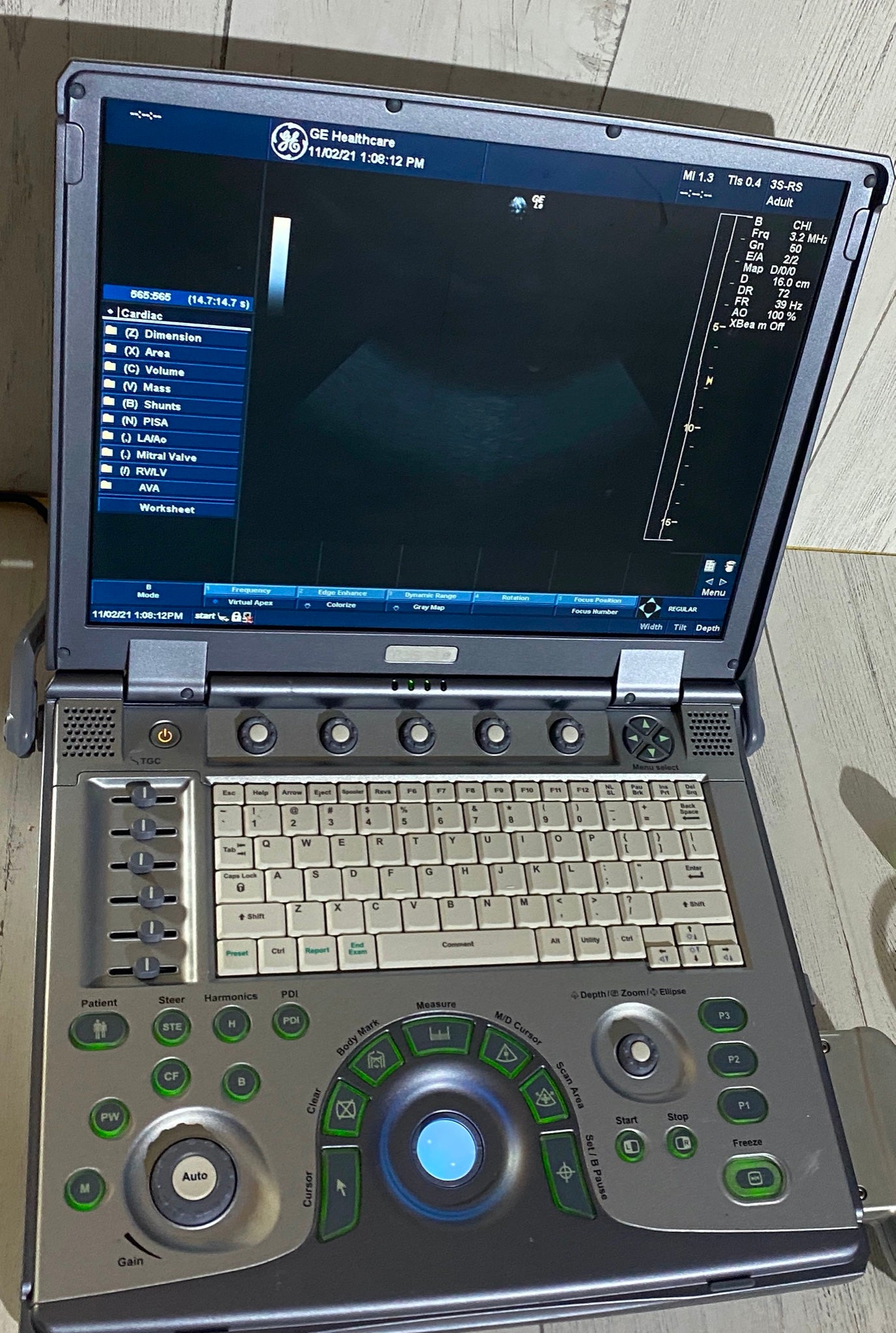 GE Logiq E portable ultrasound DIAGNOSTIC ULTRASOUND MACHINES FOR SALE