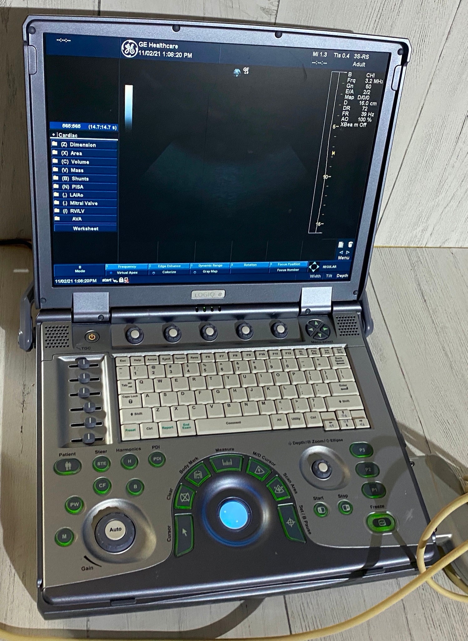 GE Logiq E portable ultrasound DIAGNOSTIC ULTRASOUND MACHINES FOR SALE