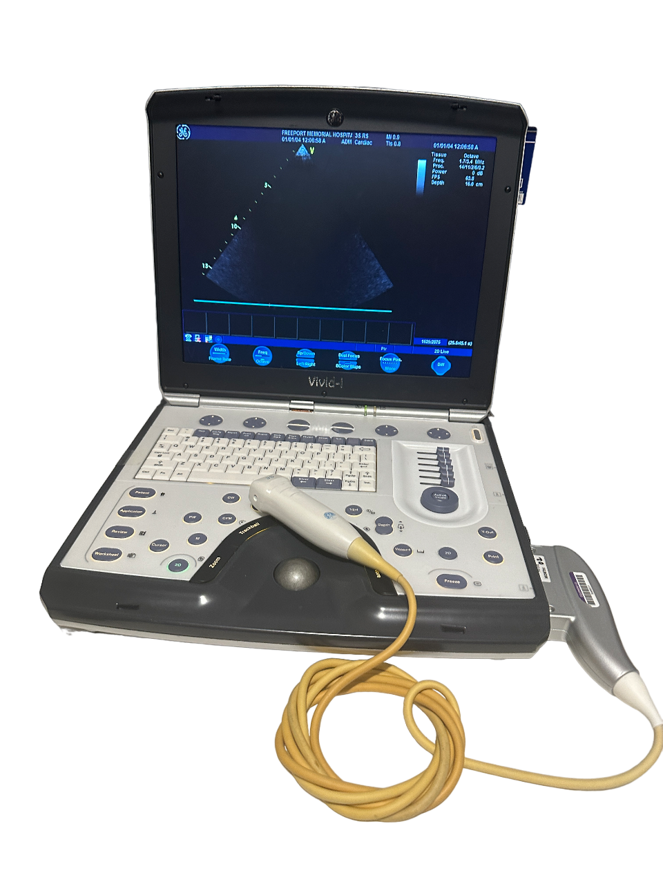 Real Life 3s Array GE Vivid I Color Doppler Ultrasound & 3S-RS Phased Array Cardiac Probe